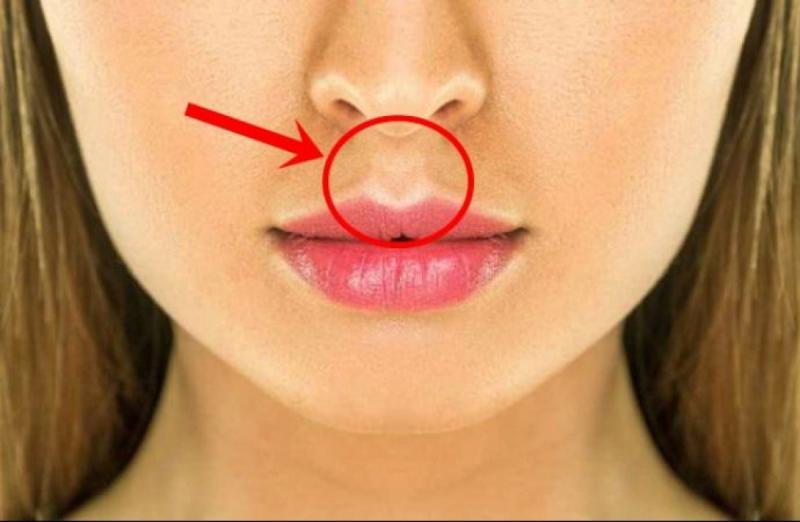 Dudak Yarasına Ne İyi Gelir?