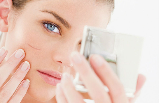 Yüzdeki Yara İzleri Nasıl Geçer?